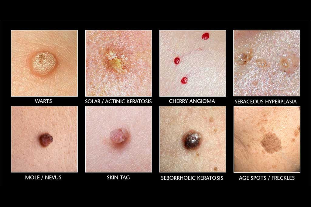 Skin Image